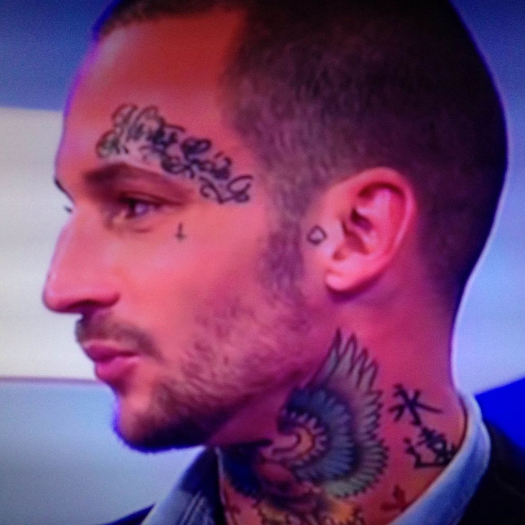 Perche Manuel Ha Una Cicatrice Sul Collo